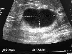 Vorbild Ultraschall 2