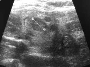 Vorbild Ultraschall 1